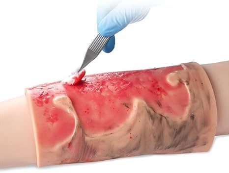 Limb Burn Training Model, Realistic Simulation Care Module for 2-3 Degree Limb Burns, Wearable Silicone Limb Burns Simulator, for Bleeding Control and Education Demonstration.
