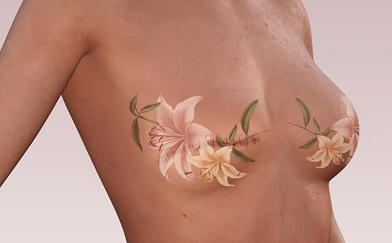 Lily Temporary Tattoo for Scars Realistic Waterproof Scar Cover Tattoo for Mastectomy, Reconstruction & Top Surgery Floral Design, Long Lasting 57 Days
