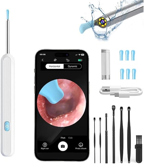 Ear Wax Removal Tool Camera Kit with 1080P HD Camera,6 LED Strong Light WiFi Connection, Ear Cleaner Removal for Precise Earwax Cleaning iOS & Android System (Mixed Black&White)