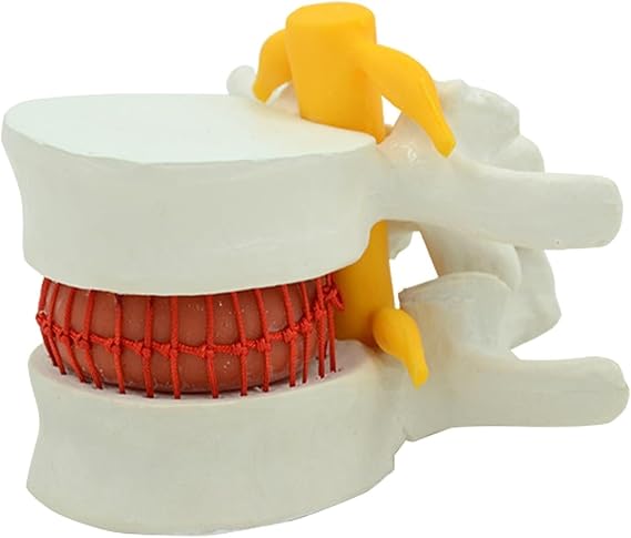 Human Anatomical Lumbar disc herniation Model, Human Muscle and Organ Model, Lumbar Vertebra Model for Teaching