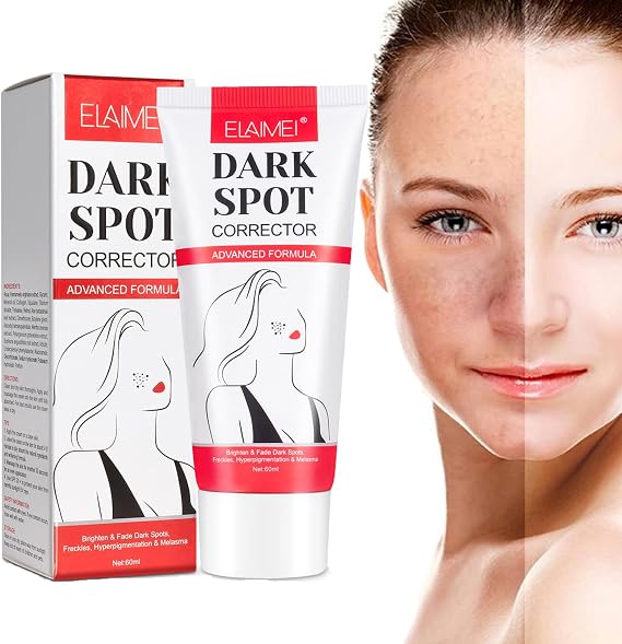 Dark Spot Corrector Remover, Lightening Cream, Spot Cream, Age Spot Cream, Pigment Spot Remover, Age Spot And Freckle Remover, Dark Spot Lightening And Fading-60Ml
